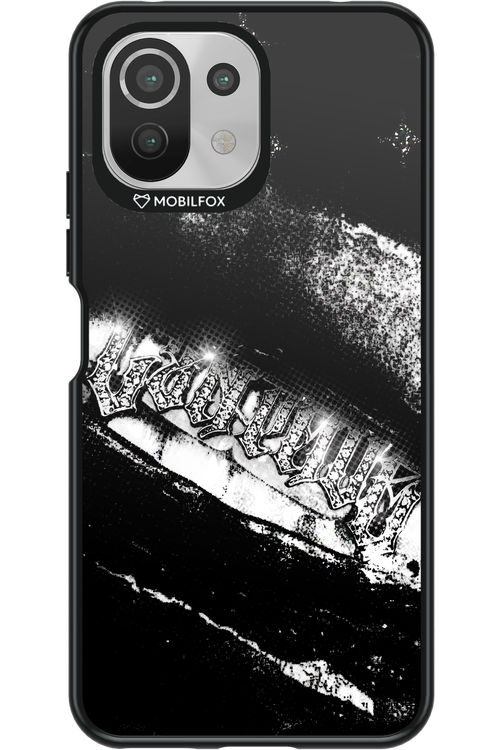 Grillz Black Centaur 2.0 - Xiaomi Mi 11 Lite (2021)