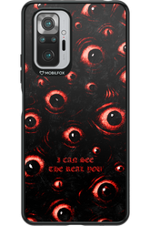 The Watchers - Xiaomi Redmi Note 10S