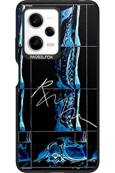 RMN Scolioza 2.0 - Xiaomi Redmi Note 12 Pro 5G