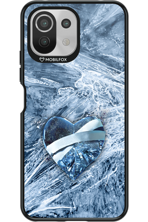 Ice 2.0 - Xiaomi Mi 11 Lite (2021)