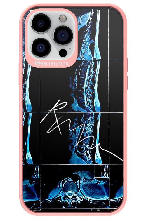 RMN Scolioza 2.0 - Apple iPhone 13 Pro Max