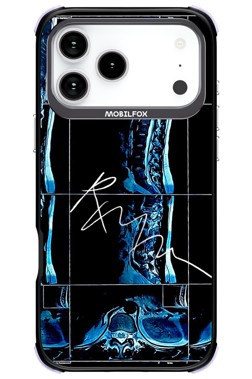 RMN Scolioza 2.0 - Apple iPhone 17 Pro Max
