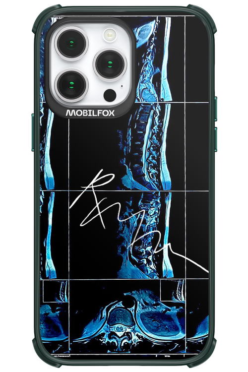 RMN Scolioza 2.0 - Apple iPhone 14 Pro Max