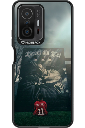 Direct Din Tei Artwork 2.0 - Xiaomi Mi 11T Pro