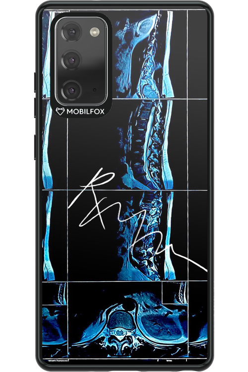 RMN Scolioza 2.0 - Samsung Galaxy Note 20