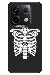 SKELETON - Xiaomi Redmi Note 13 Pro 5G
