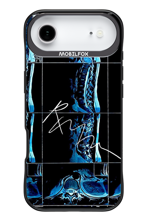 RMN Scolioza 2.0 - Apple iPhone 17 Air