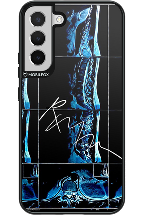 RMN Scolioza 2.0 - Samsung Galaxy S22+