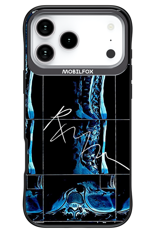 RMN Scolioza 2.0 - Apple iPhone 17 Pro Max
