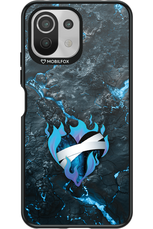 Icefire 2.0 - Xiaomi Mi 11 Lite (2021)