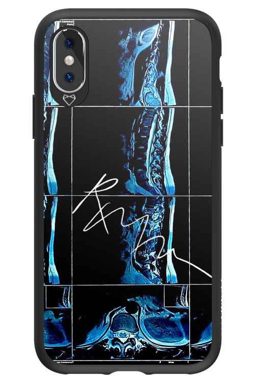 RMN Scolioza 2.0 - Apple iPhone XS