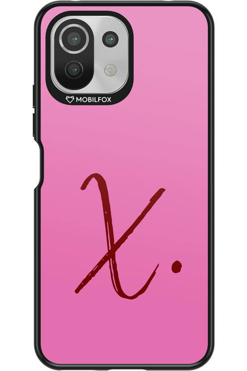 (Sorbet) X 2.0 - Xiaomi Mi 11 Lite (2021)