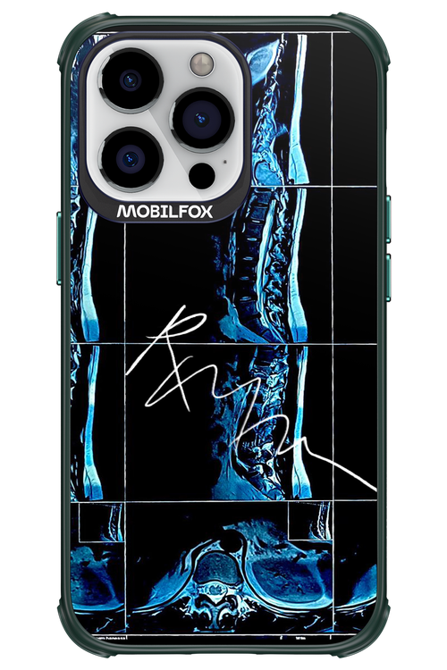 RMN Scolioza 2.0 - Apple iPhone 13 Pro