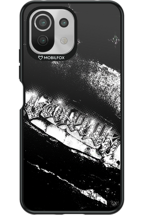 Grillz Black Centaur 2.0 - Xiaomi Mi 11 Lite (2021)