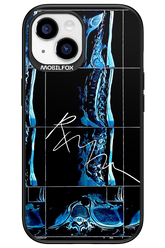 RMN Scolioza 2.0 - Apple iPhone 15