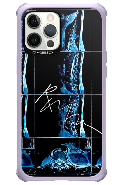 RMN Scolioza 2.0 - Apple iPhone 12 Pro Max