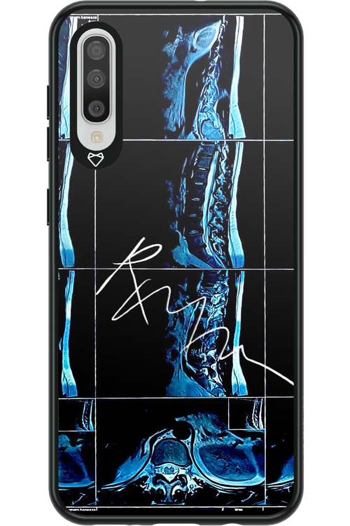 RMN Scolioza 2.0 - Samsung Galaxy A50