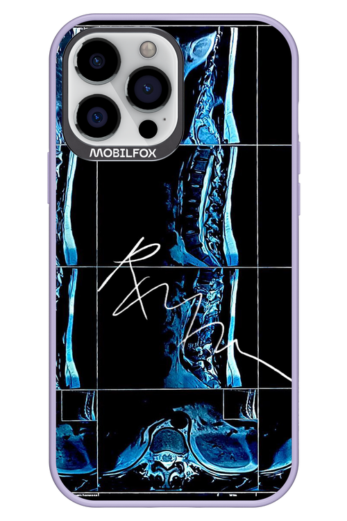 RMN Scolioza 2.0 - Apple iPhone 13 Pro Max