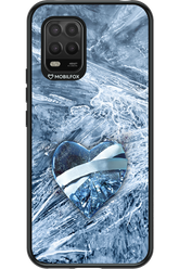 Ice 2.0 - Xiaomi Mi 10 Lite 5G