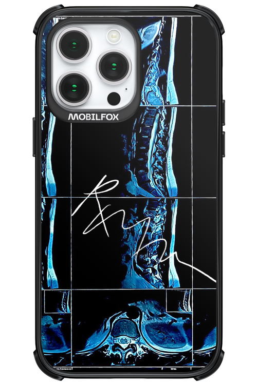 RMN Scolioza 2.0 - Apple iPhone 14 Pro Max