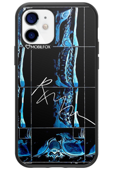 RMN Scolioza 2.0 - Apple iPhone 12
