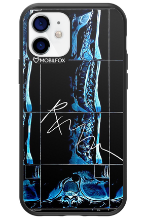RMN Scolioza 2.0 - Apple iPhone 12