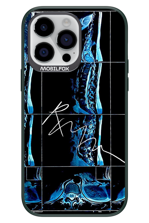 RMN Scolioza 2.0 - Apple iPhone 14 Pro Max