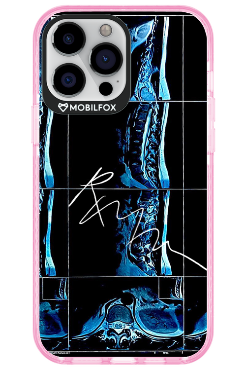 RMN Scolioza 2.0 - Apple iPhone 13 Pro Max