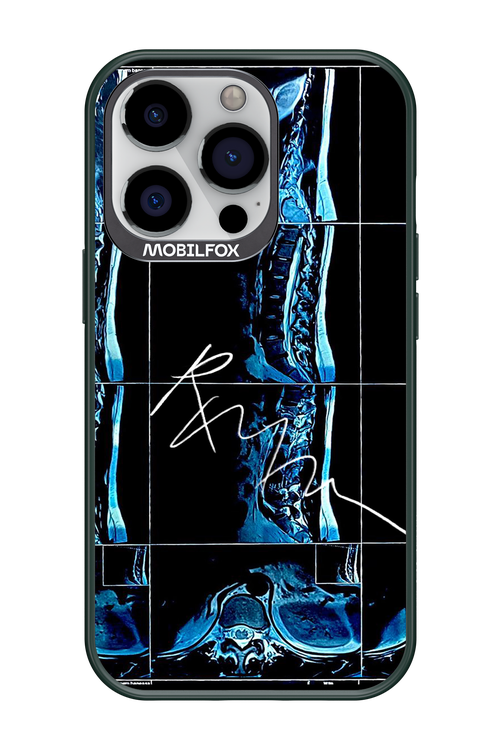 RMN Scolioza 2.0 - Apple iPhone 13 Pro
