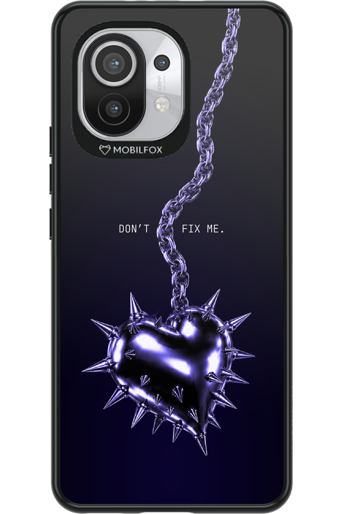 Don't fix me 2.0 - Xiaomi Mi 11 5G