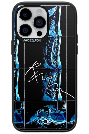 RMN Scolioza 2.0 - Apple iPhone 14 Pro Max