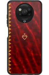 Spania x Mobilfox 2.0 - Xiaomi Poco X3 NFC