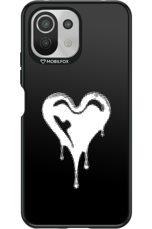 Heart Black - Xiaomi Mi 11 Lite (2021)