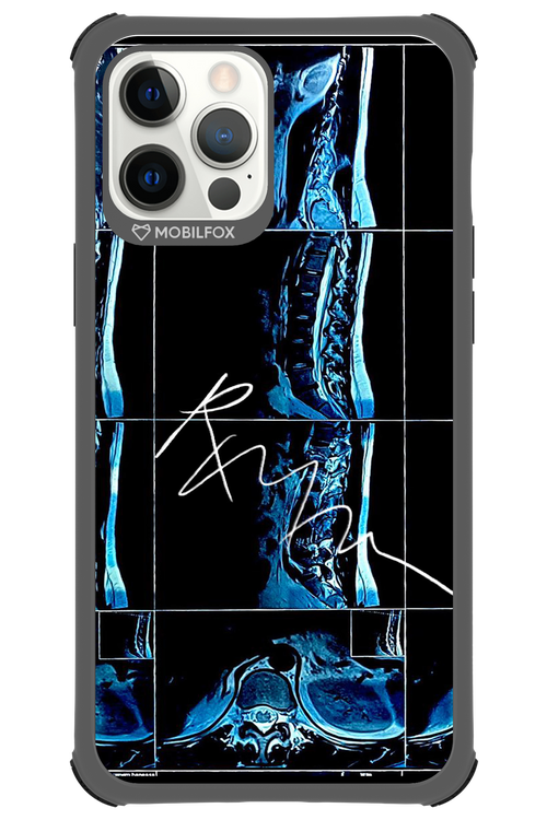 RMN Scolioza 2.0 - Apple iPhone 12 Pro Max