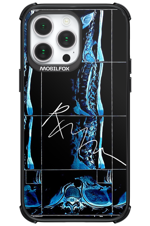 RMN Scolioza 2.0 - Apple iPhone 14 Pro Max