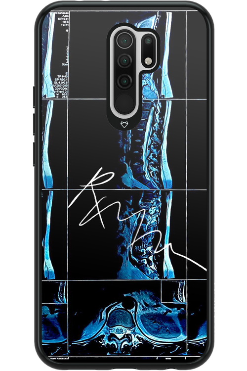 RMN Scolioza 2.0 - Xiaomi Redmi 9