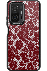 Lace Lover - Xiaomi Mi 11T Pro