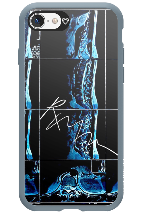 RMN Scolioza 2.0 - Apple iPhone SE 2022
