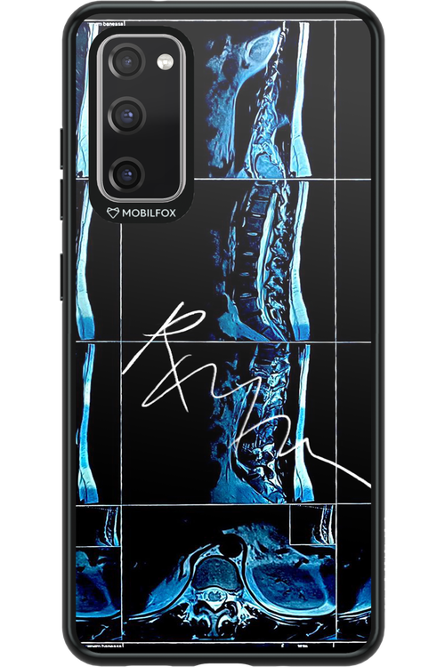 RMN Scolioza 2.0 - Samsung Galaxy S20 FE