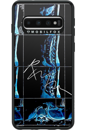 RMN Scolioza 2.0 - Samsung Galaxy S10