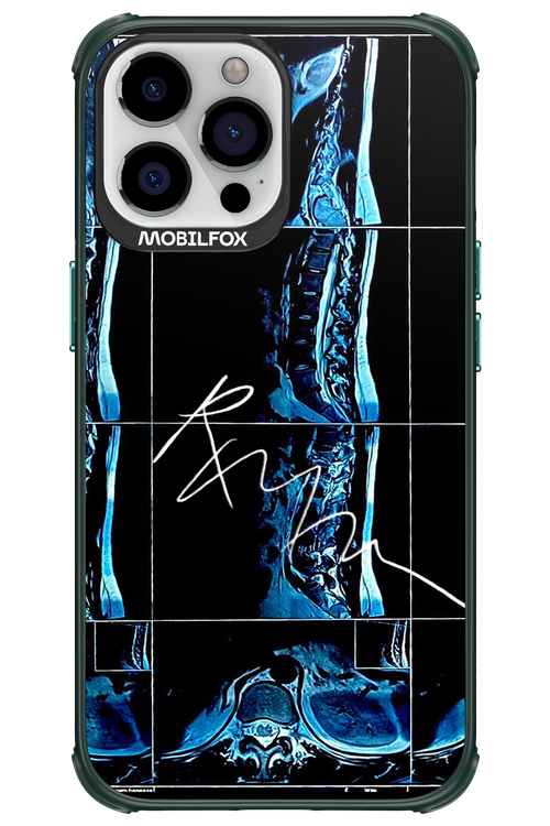 RMN Scolioza 2.0 - Apple iPhone 13 Pro Max