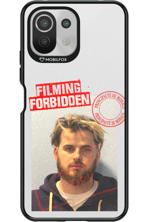 ZBIR Mugshot 2.0 - Xiaomi Mi 11 Lite (2021)