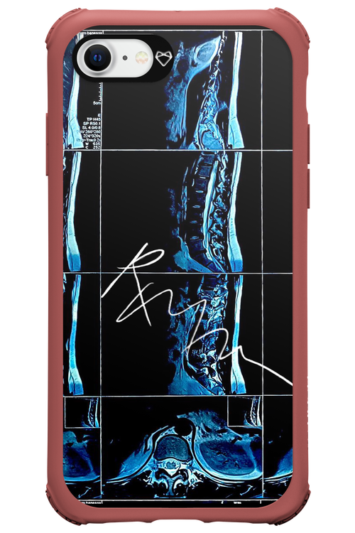 RMN Scolioza 2.0 - Apple iPhone 7