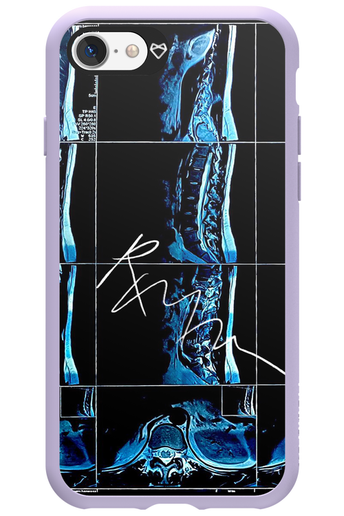 RMN Scolioza 2.0 - Apple iPhone 7