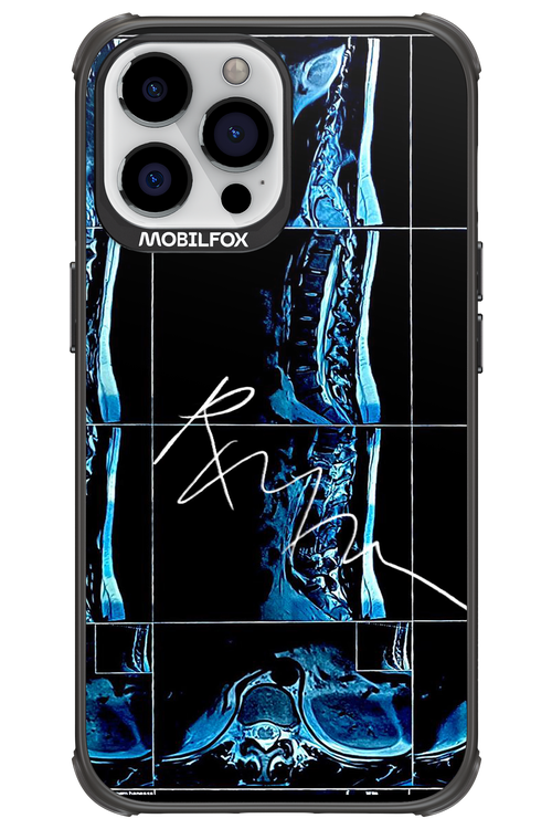 RMN Scolioza 2.0 - Apple iPhone 13 Pro Max