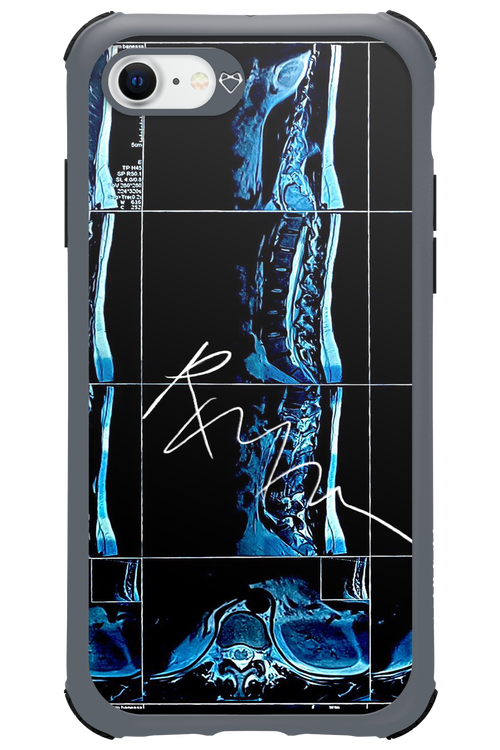 RMN Scolioza 2.0 - Apple iPhone SE 2022