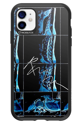 RMN Scolioza 2.0 - Apple iPhone 11