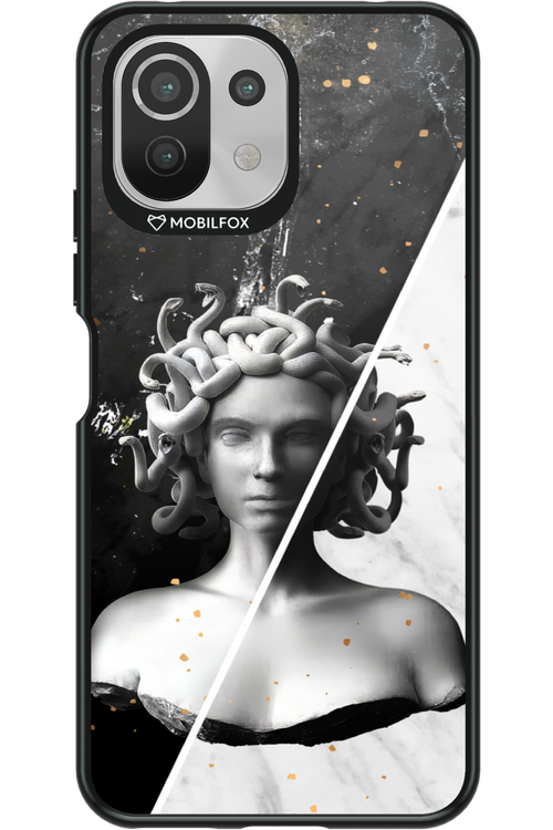 Medusa - Xiaomi Mi 11 Lite (2021)