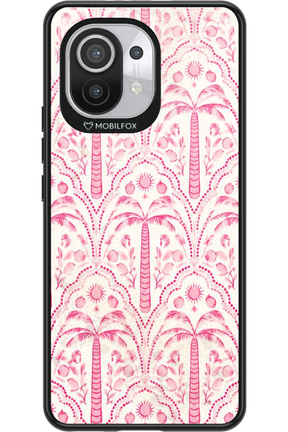Pink Palm 2.0 - Xiaomi Mi 11 5G