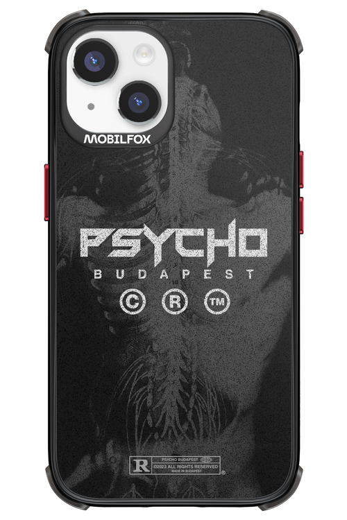 X-Ray - Apple iPhone 14